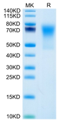 Human DcR1/TRAILR3 on Tris-Bis PAGE under reduced condition. The purity is greater than 95%.