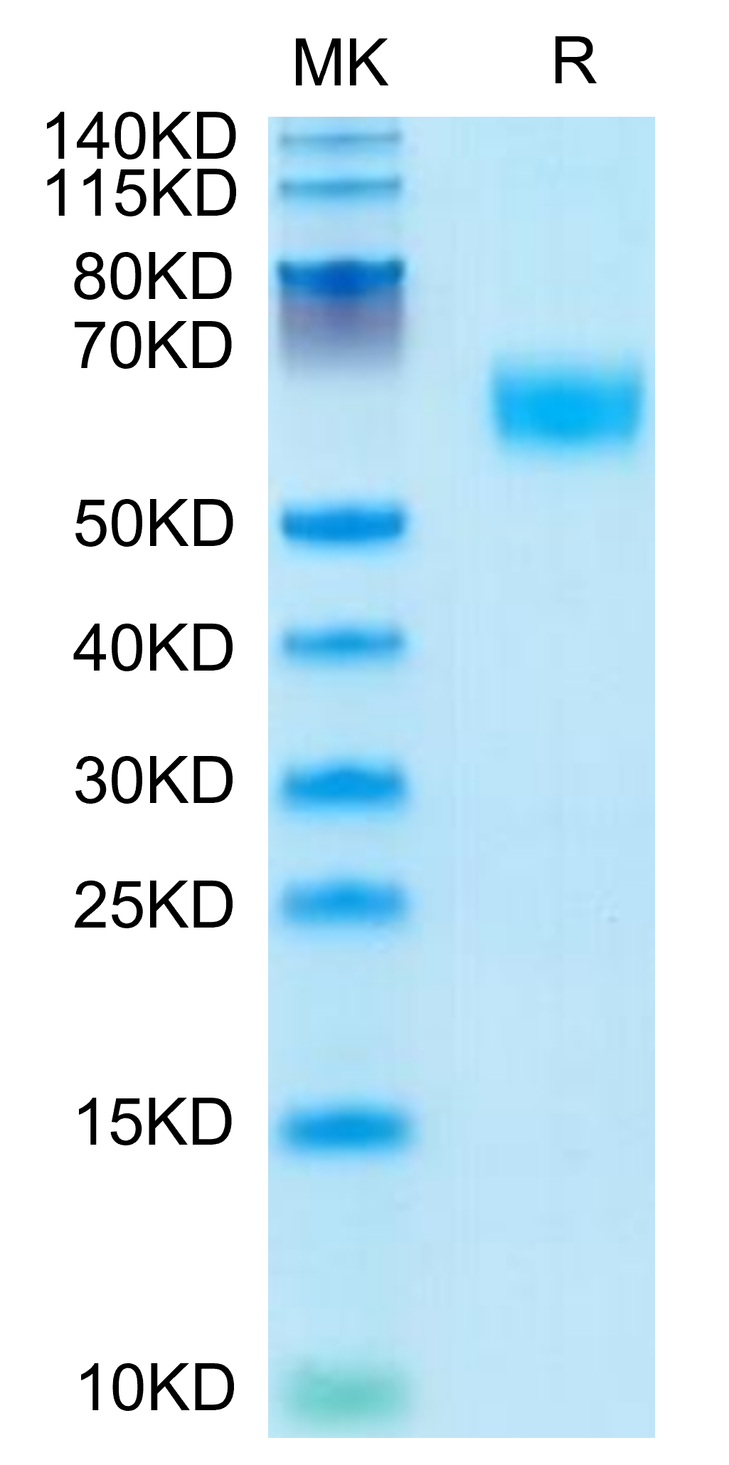 Mouse AMIGO2 on Tris-Bis PAGE under reduced condition. The purity is greater than 95%.