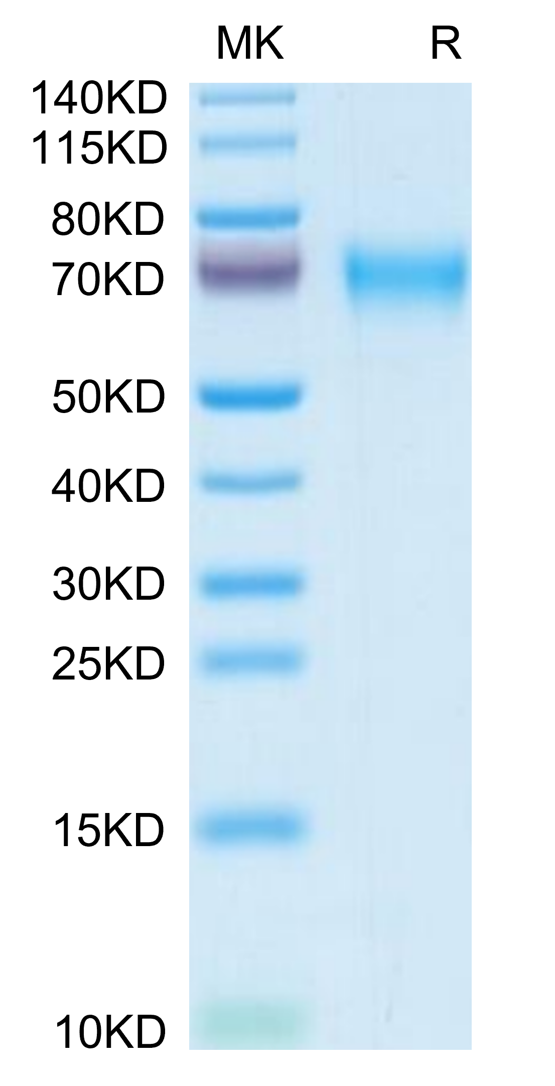 Mouse LCAT on Tris-Bis PAGE under reduced condition. The purity is greater than 95%.