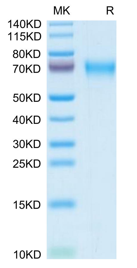 Mouse LCAT on Tris-Bis PAGE under reduced condition. The purity is greater than 95%.