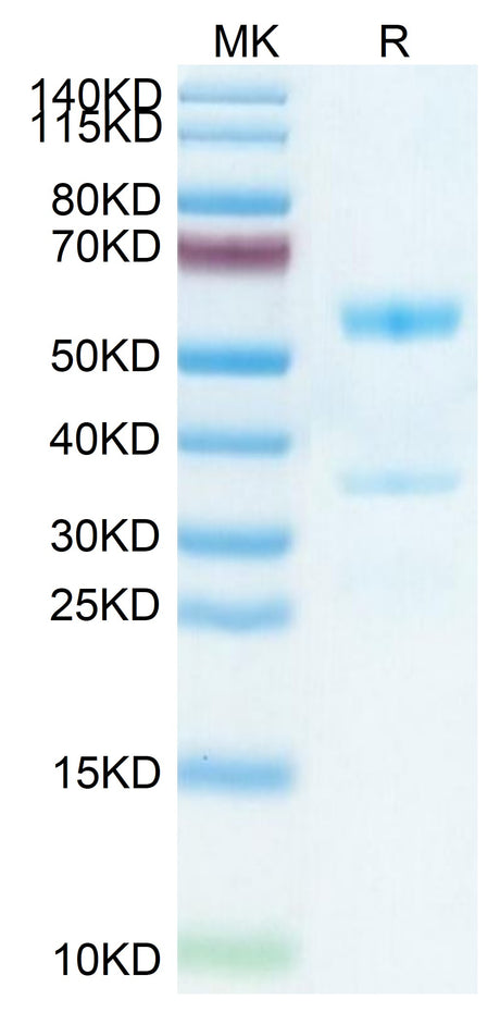 Mouse MFAP5 on Tris-Bis PAGE under reduced condition. The purity is greater than 95%.