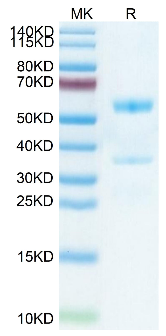Mouse MFAP5 on Tris-Bis PAGE under reduced condition. The purity is greater than 95%.