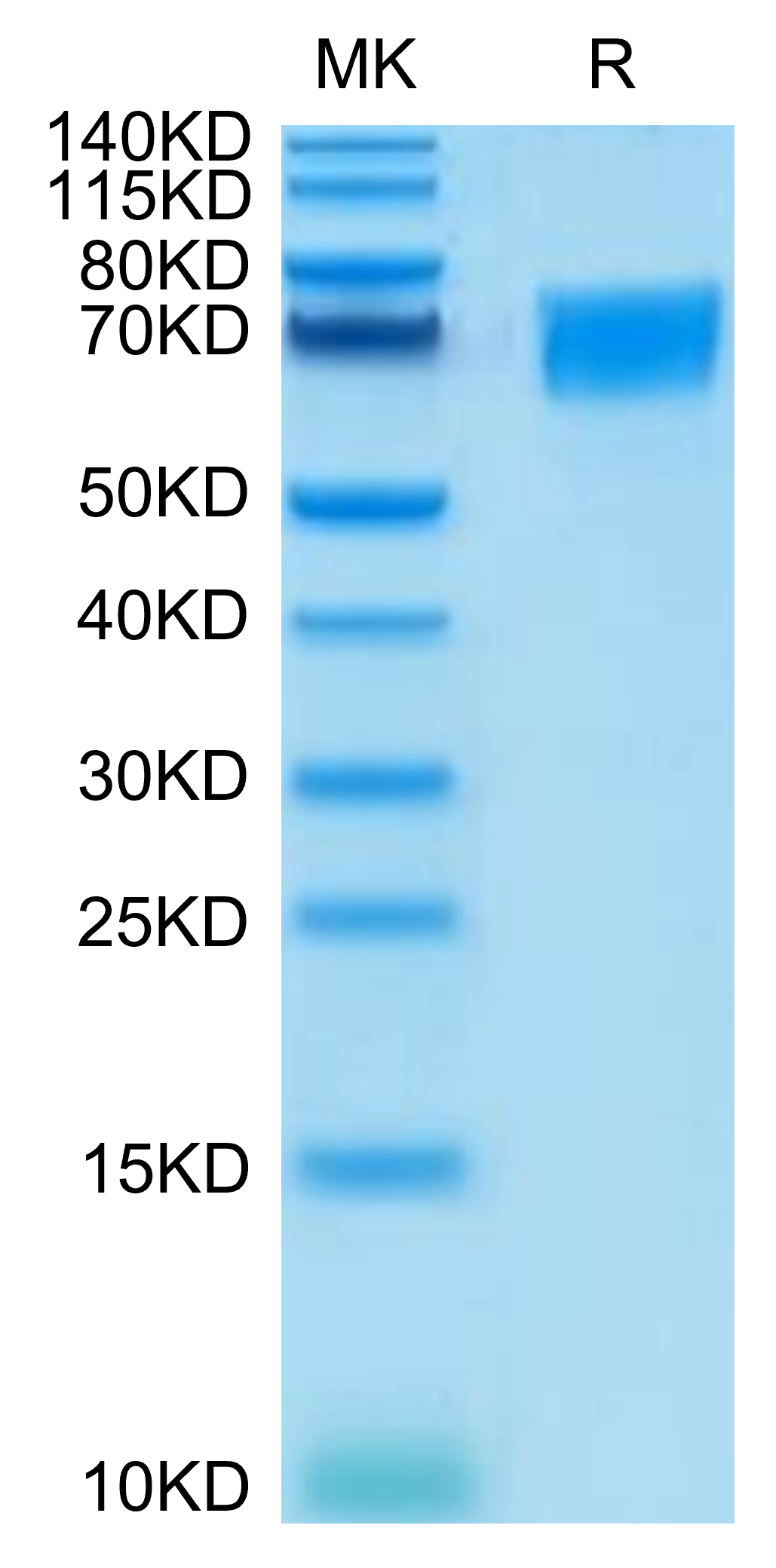 Human CD58 on Tris-Bis PAGE under reduced condition. The purity is greater than 95%.