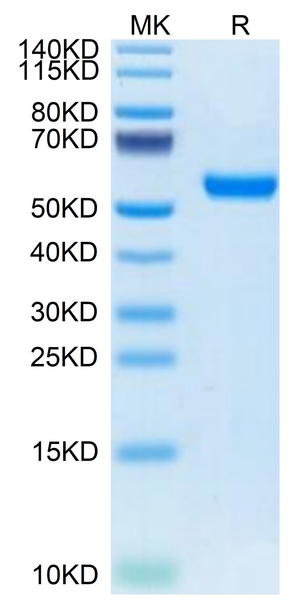 Mouse RNF43 on Tris-Bis PAGE under reduced condition. The purity is greater than 95%.