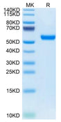 Mouse RNF43 on Tris-Bis PAGE under reduced condition. The purity is greater than 95%.