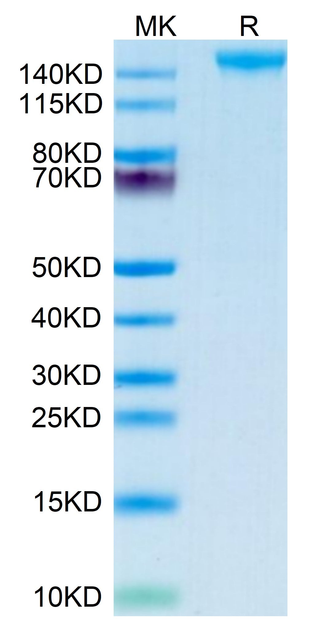 Mouse SEZ6 on Tris-Bis PAGE under reduced condition. The purity is greater than 95%.