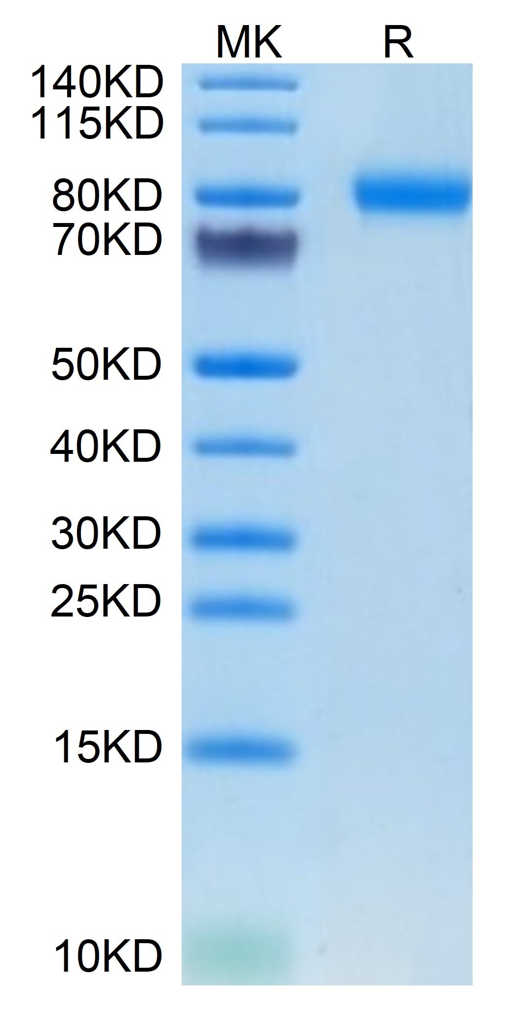 Mouse SEMA4B on Tris-Bis PAGE under reduced condition. The purity is greater than 95%.
