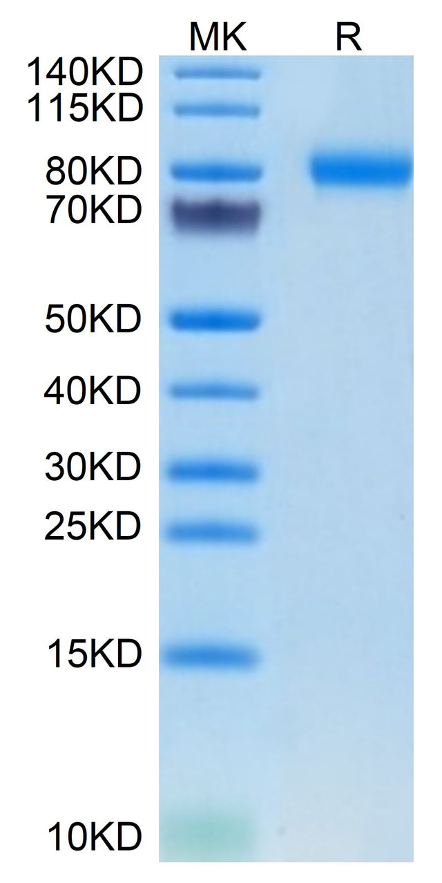 Mouse SEMA4B on Tris-Bis PAGE under reduced condition. The purity is greater than 95%.