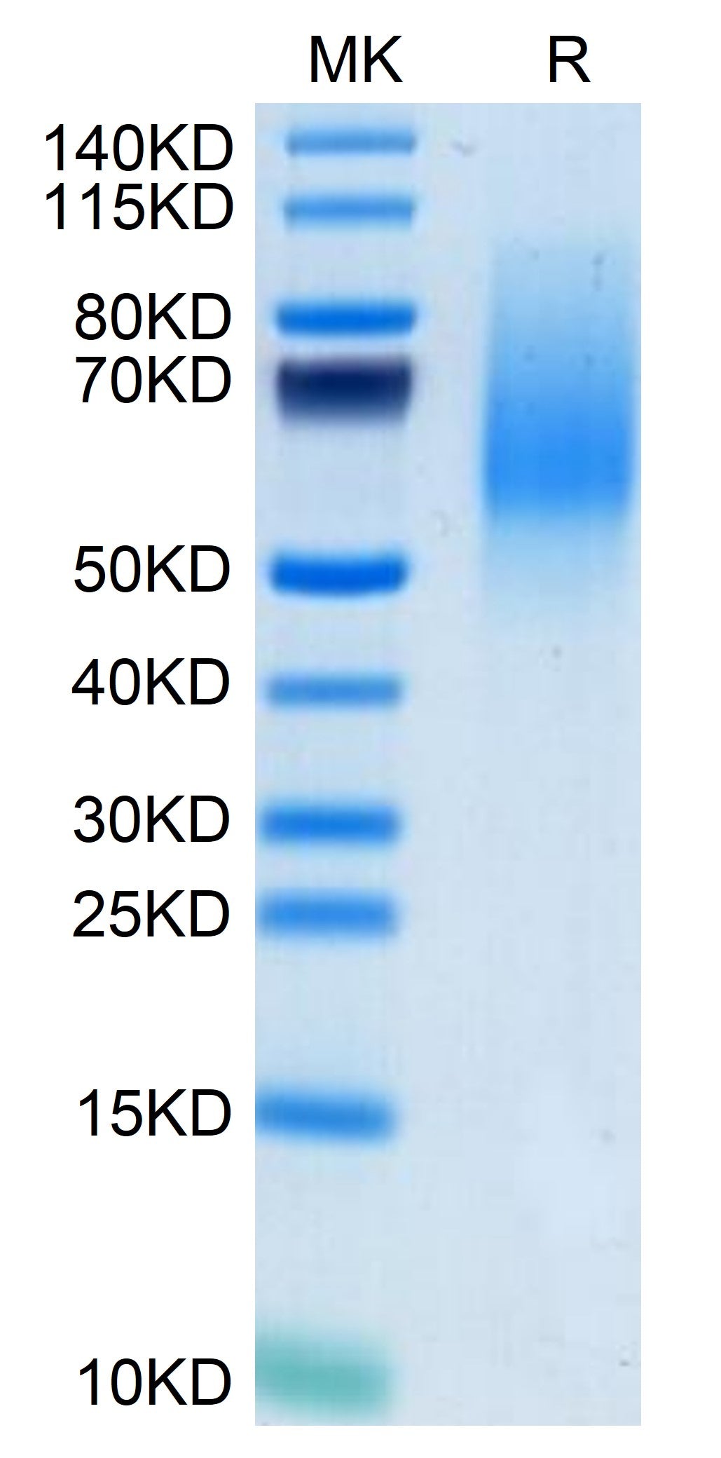 Mouse MANSC1 on Tris-Bis PAGE under reduced condition. The purity is greater than 95%.
