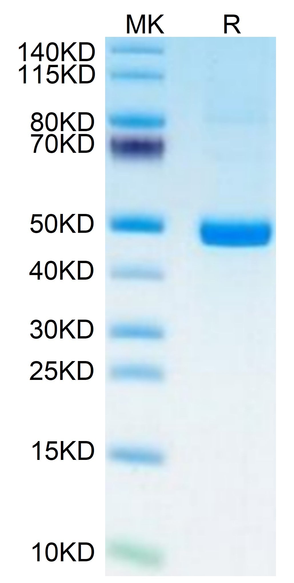 Human PSMP on Tris-Bis PAGE under reduced condition. The purity is greater than 95%.