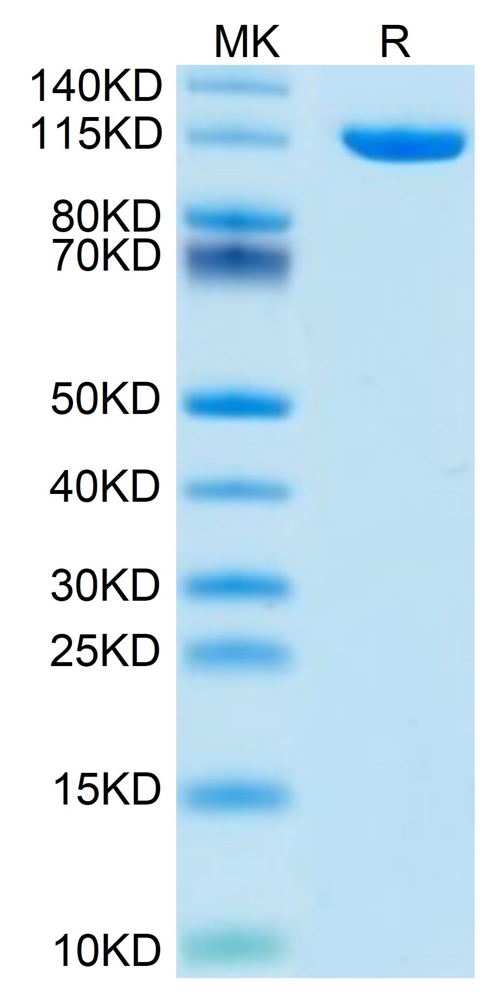 Mouse Neuropilin-2 on Tris-Bis PAGE under reduced condition. The purity is greater than 95%.