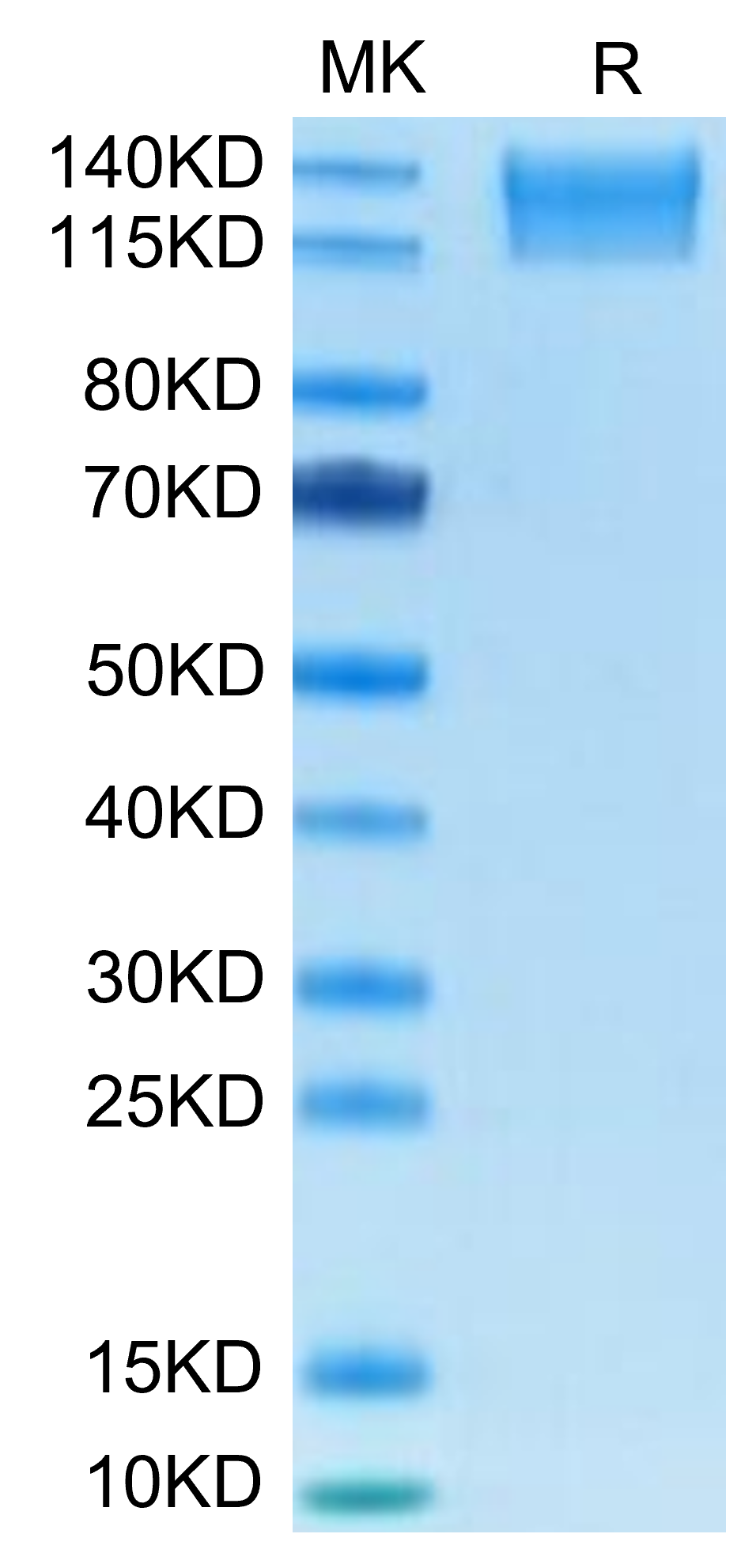 Mouse SEZ6L2 on Tris-Bis PAGE under reduced condition. The purity is greater than 95%.