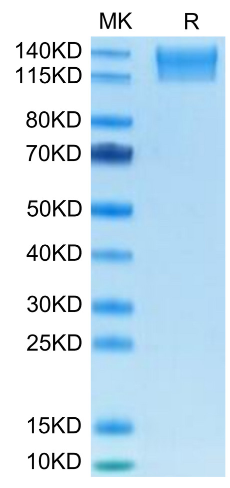 Mouse SEZ6L2 on Tris-Bis PAGE under reduced condition. The purity is greater than 95%.