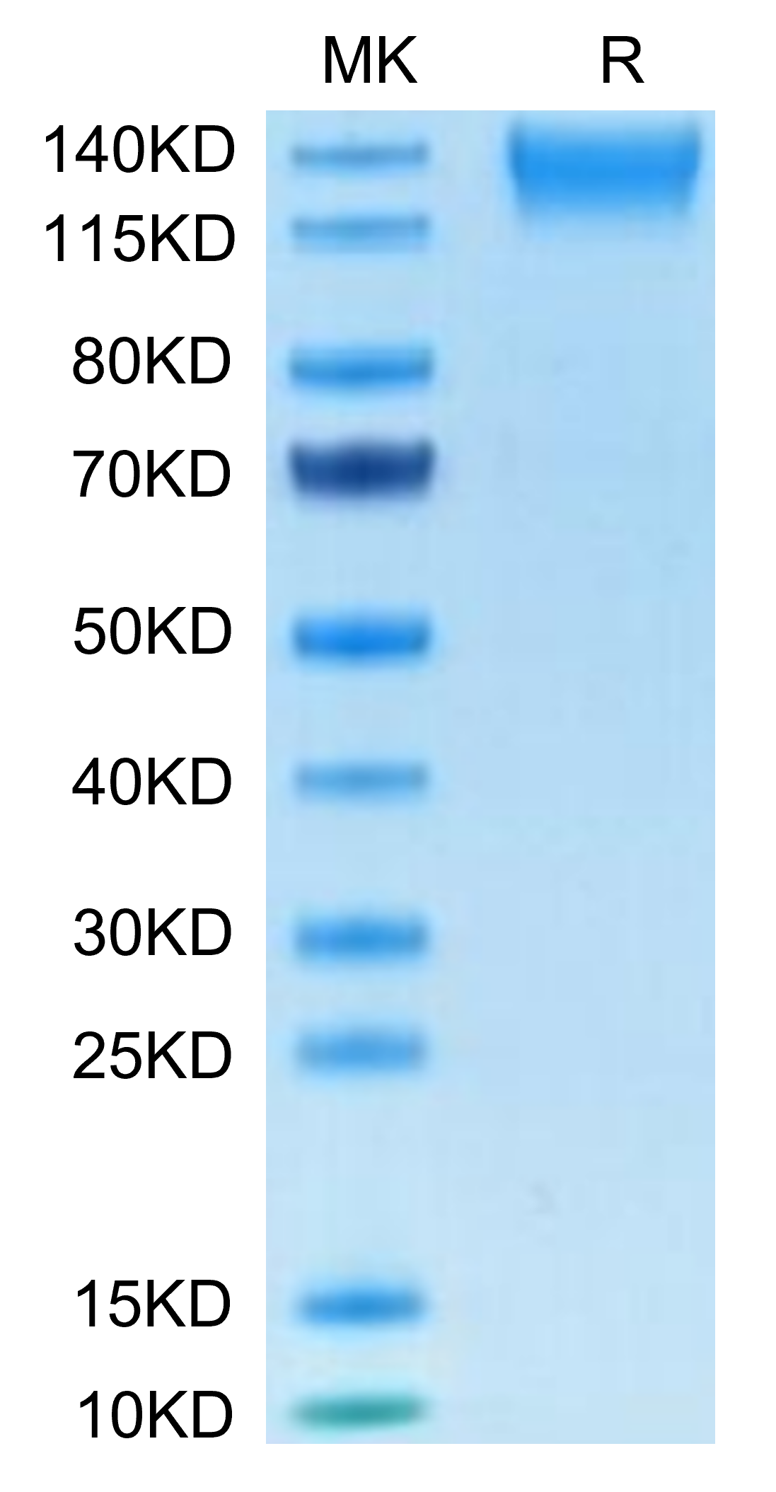 Human SEZ6L2 on Tris-Bis PAGE under reduced condition. The purity is greater than 95%.