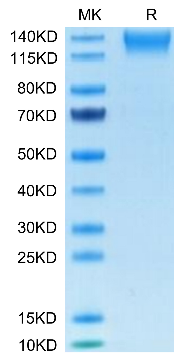 Human SEZ6L2 on Tris-Bis PAGE under reduced condition. The purity is greater than 95%.