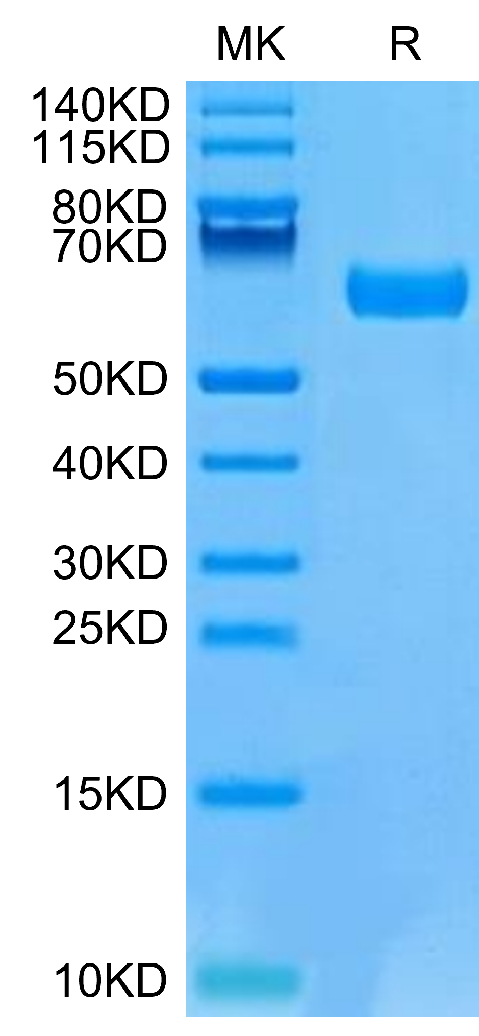 Mouse B7-H5 on Tris-Bis PAGE under reduced condition. The purity is greater than 95%.