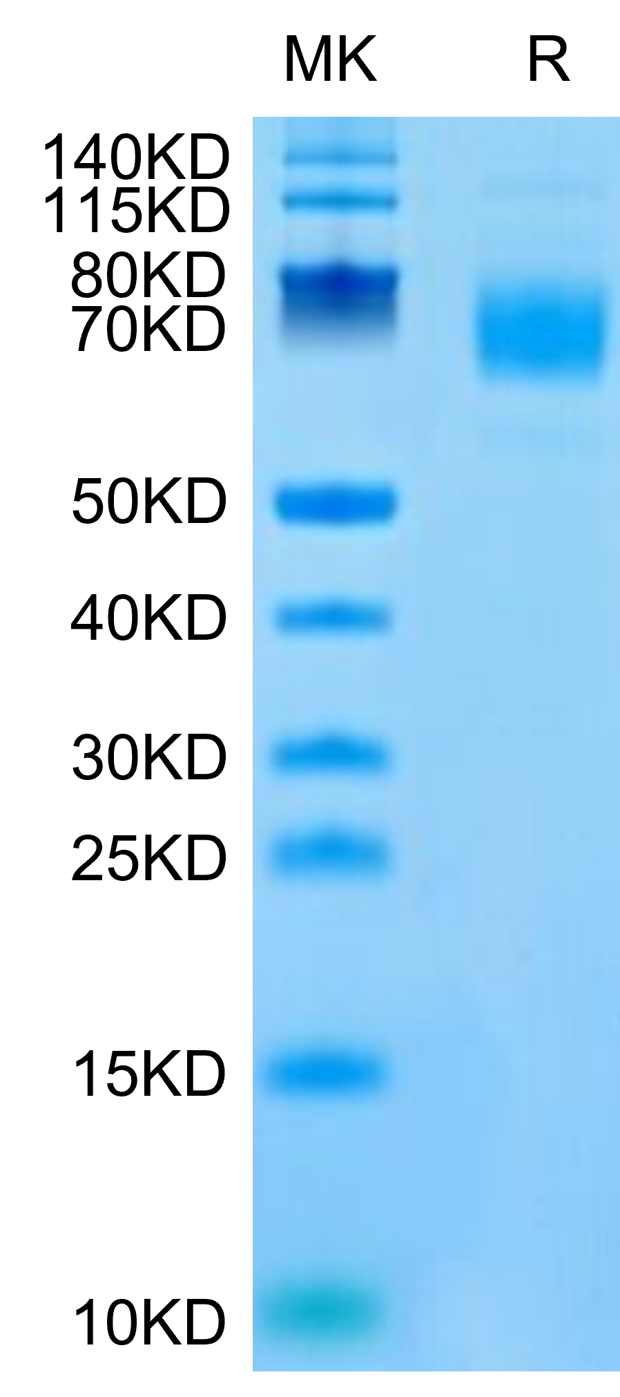 Mouse CSPG5 on Tris-Bis PAGE under reduced condition. The purity is greater than 95%.