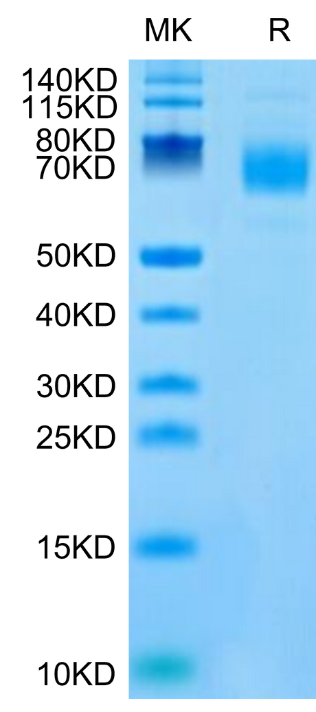 Mouse CSPG5 on Tris-Bis PAGE under reduced condition. The purity is greater than 95%.