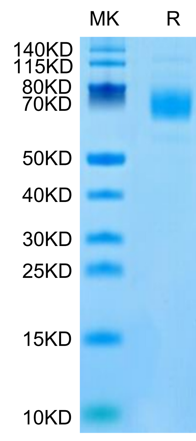 Mouse CSPG5 on Tris-Bis PAGE under reduced condition. The purity is greater than 95%.