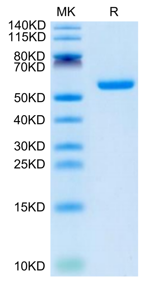 Human CSPG5 on Tris-Bis PAGE under reduced condition. The purity is greater than 95%.