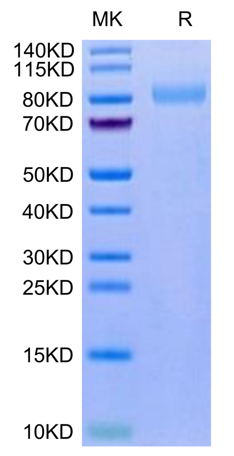 Mouse LRRN1 on Tris-Bis PAGE under reduced condition. The purity is greater than 95%.