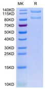Human ITGAX&ITGB2 on Tris-Bis PAGE under reduced condition. The purity is greater than 95%.