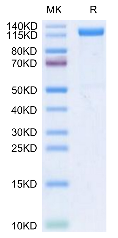 Human Beta Klotho on Tris-Bis PAGE under reduced conditions. The purity is greater than 95%.