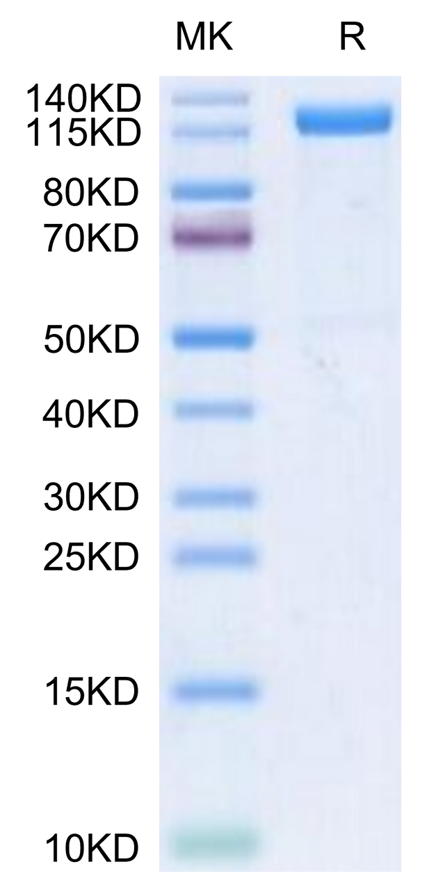 Human Beta Klotho on Tris-Bis PAGE under reduced conditions. The purity is greater than 95%.
