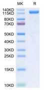 Human Beta Klotho on Tris-Bis PAGE under reduced conditions. The purity is greater than 95%.