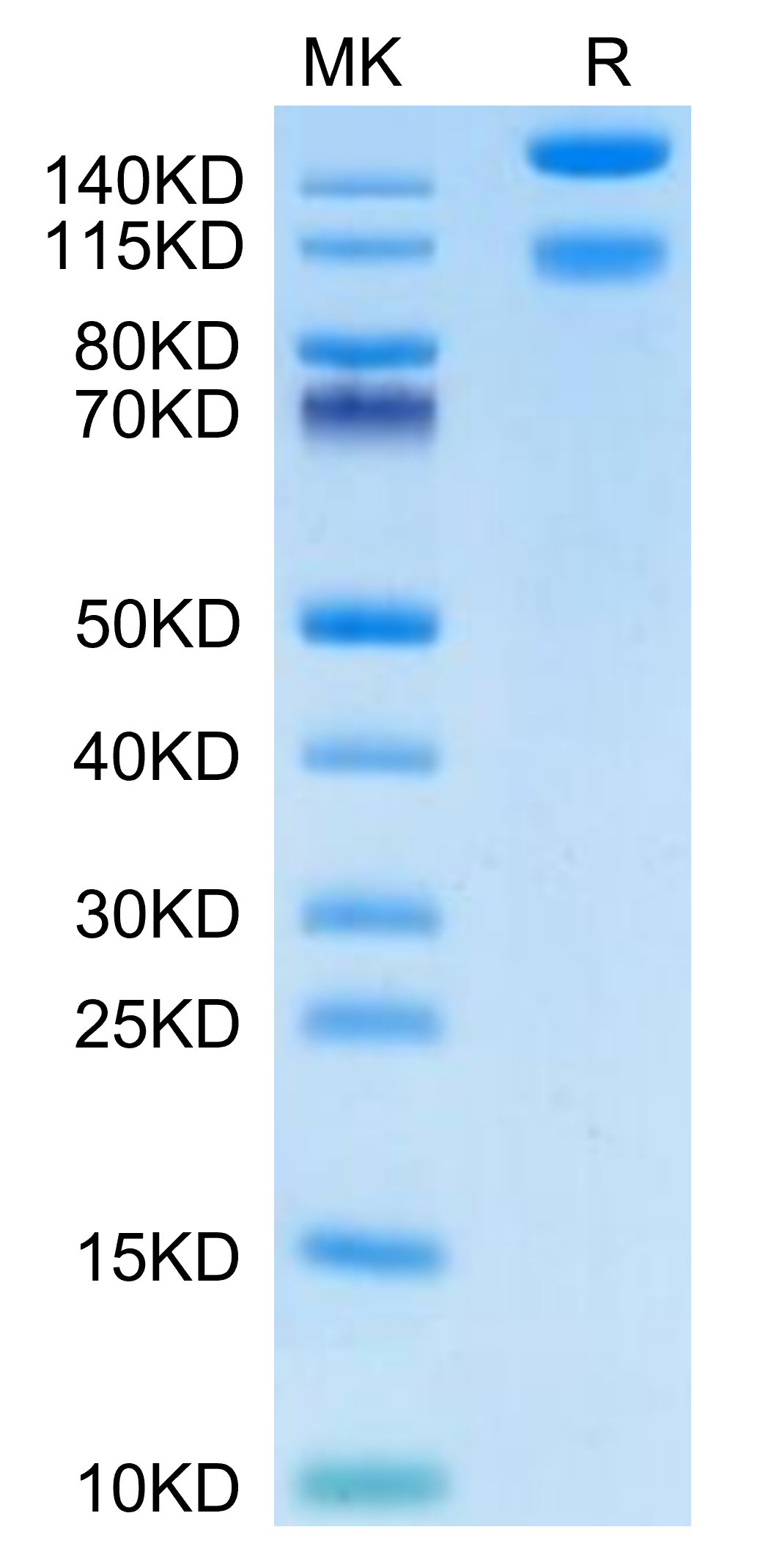 Mouse ITGA1&ITGB1 on Tris-Bis PAGE under reduced condition. The purity is greater than 95%.