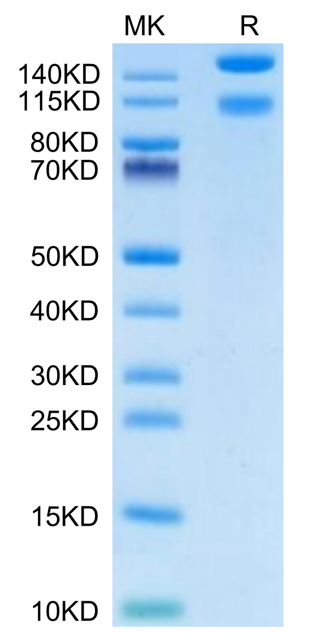 Mouse ITGA1&ITGB1 on Tris-Bis PAGE under reduced condition. The purity is greater than 95%.