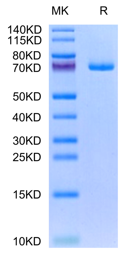 Human GAS6 on Tris-Bis PAGE under reduced condition. The purity is greater than 95%.