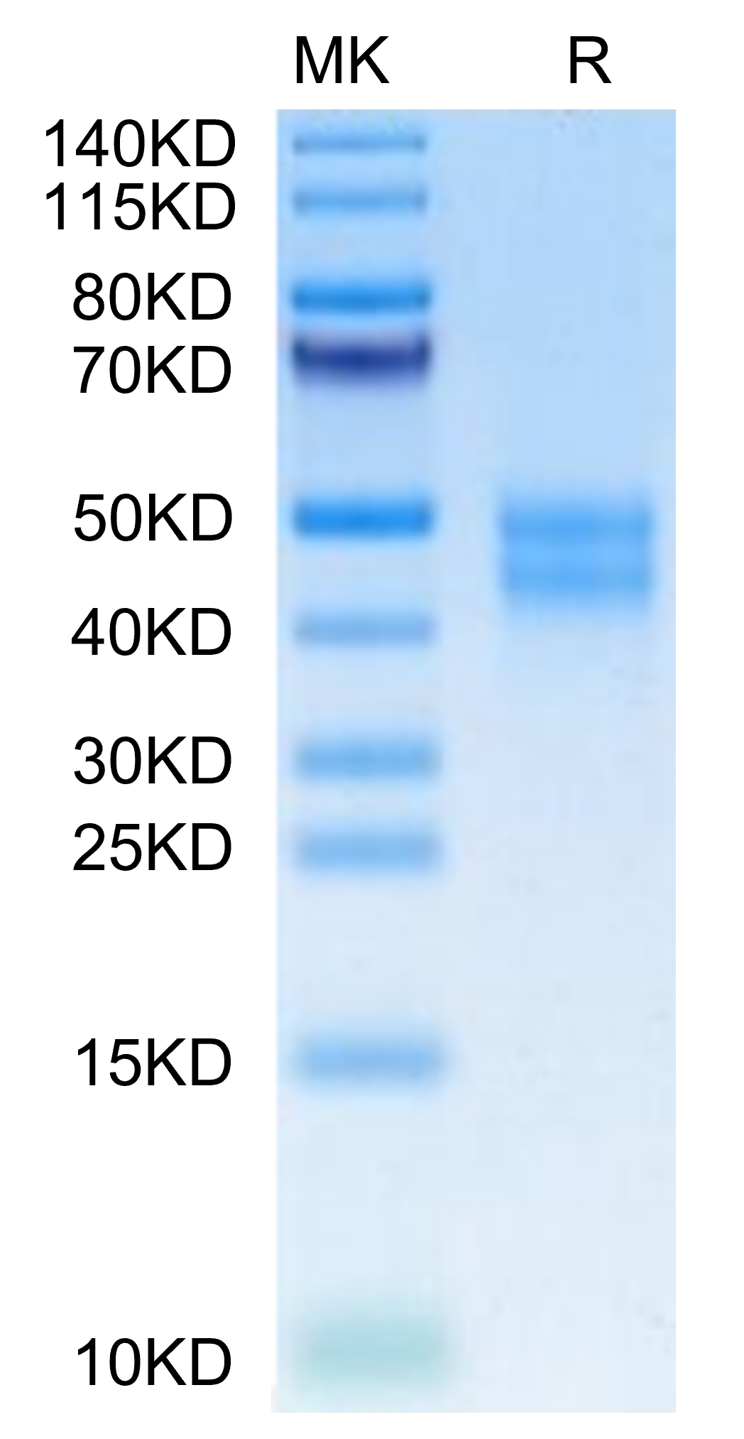 Mouse MXRA8 on Tris-Bis PAGE under reduced condition. The purity is greater than 95%.