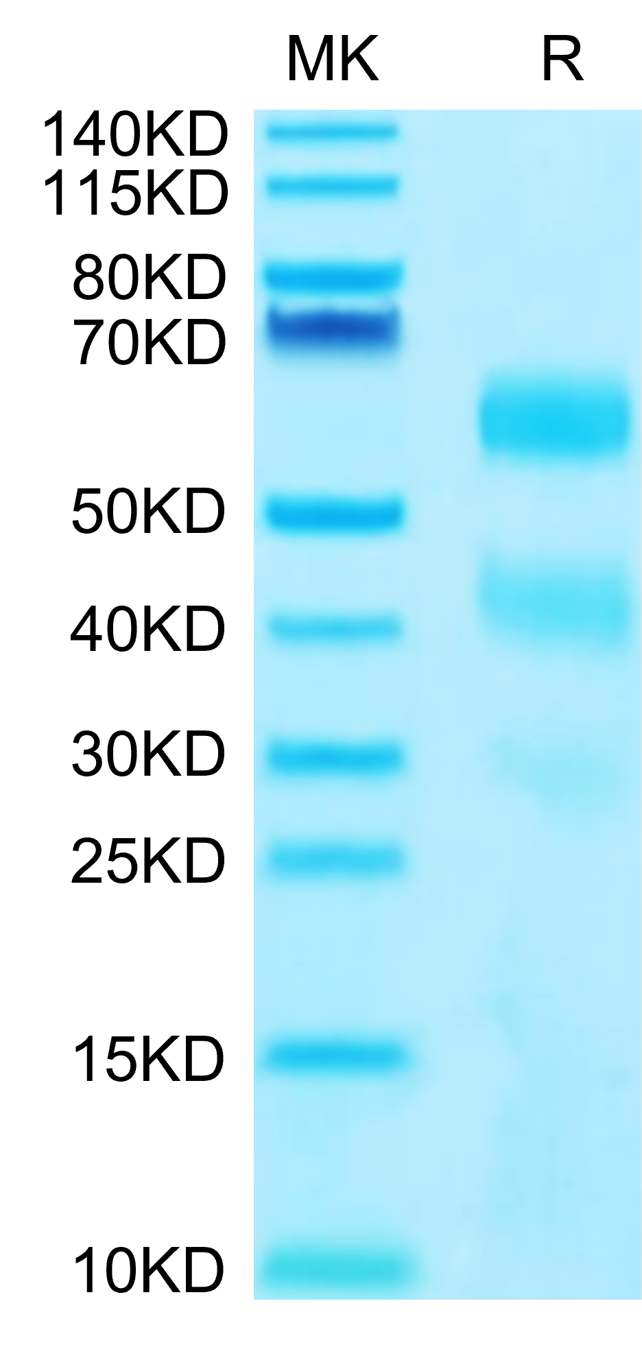 Human KIR3DL2 on Tris-Bis PAGE under reduced conditions. The purity is greater than 95%.
