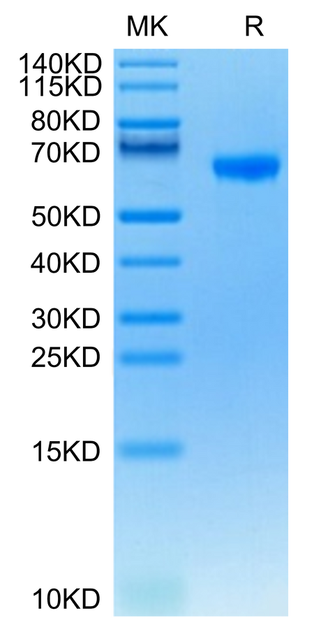 Human FCRL2 on Tris-Bis PAGE under reduced condition. The purity is greater than 95%.