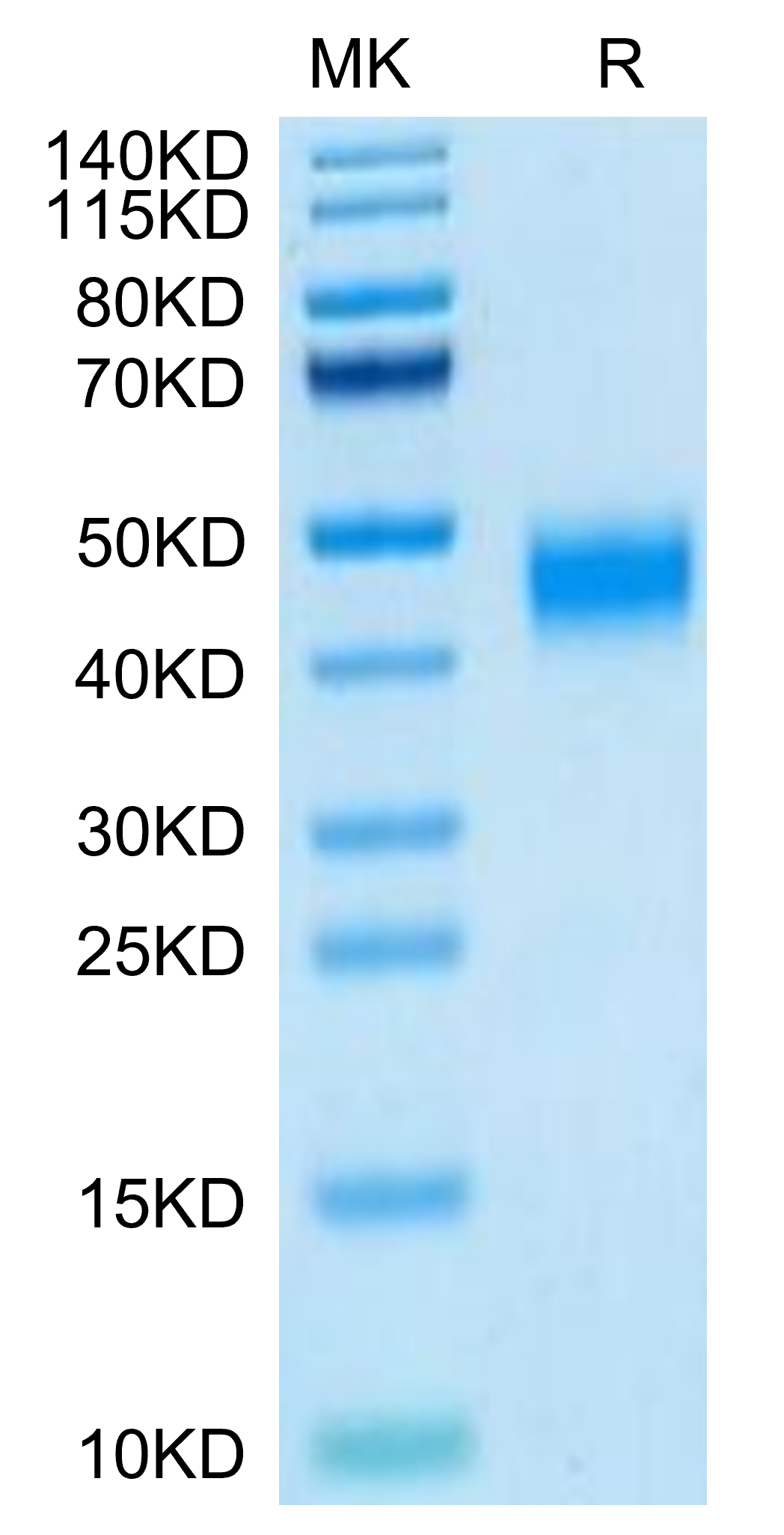 Human MXRA8 on Tris-Bis PAGE under reduced condition. The purity is greater than 95%.