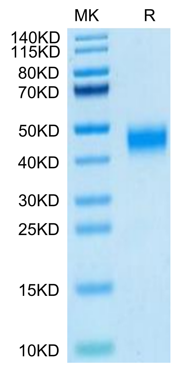 Human MXRA8 on Tris-Bis PAGE under reduced condition. The purity is greater than 95%.