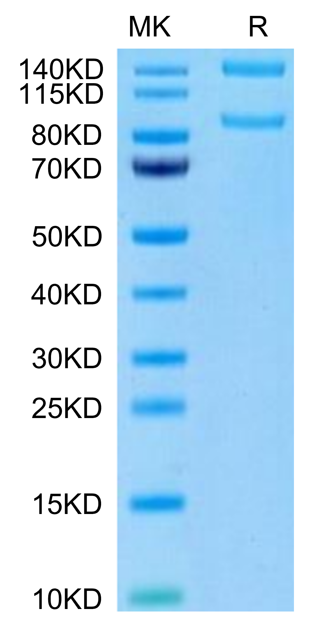 Human ITGAM&ITGB2 on Tris-Bis PAGE under reduced condition. The purity is greater than 95%.