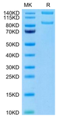 Human ITGAM&ITGB2 on Tris-Bis PAGE under reduced condition. The purity is greater than 95%.