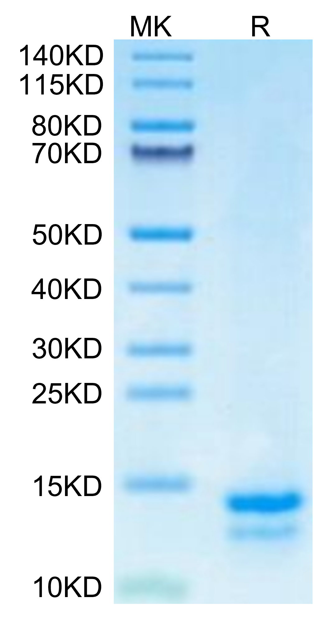 Mouse FAM19A5 on Tris-Bis PAGE under reduced condition. The purity is greater than 95%.