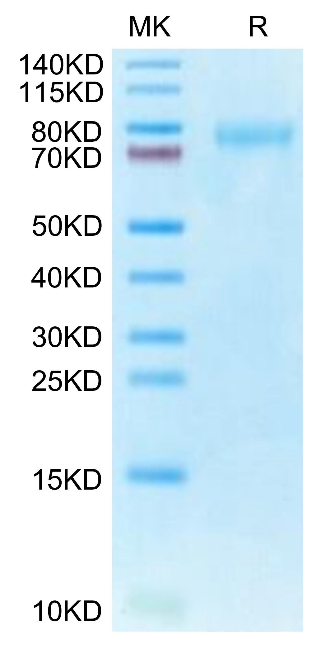 Human CLEC14A on Tris-Bis PAGE under reduced condition. The purity is greater than 95%.