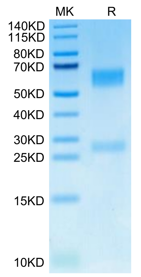 Human GGT1 on Tris-Bis PAGE under reduced condition. The purity is greater than 95%.
