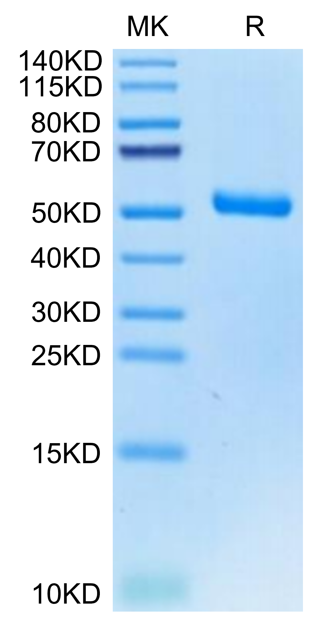 Human EVA-1 on Tris-Bis PAGE under reduced condition. The purity is greater than 95%.