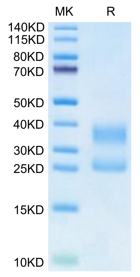 Biotinylated Human CD3E&CD3D on Tris-Bis PAGE under reduced condition. The purity is greater than 95%.