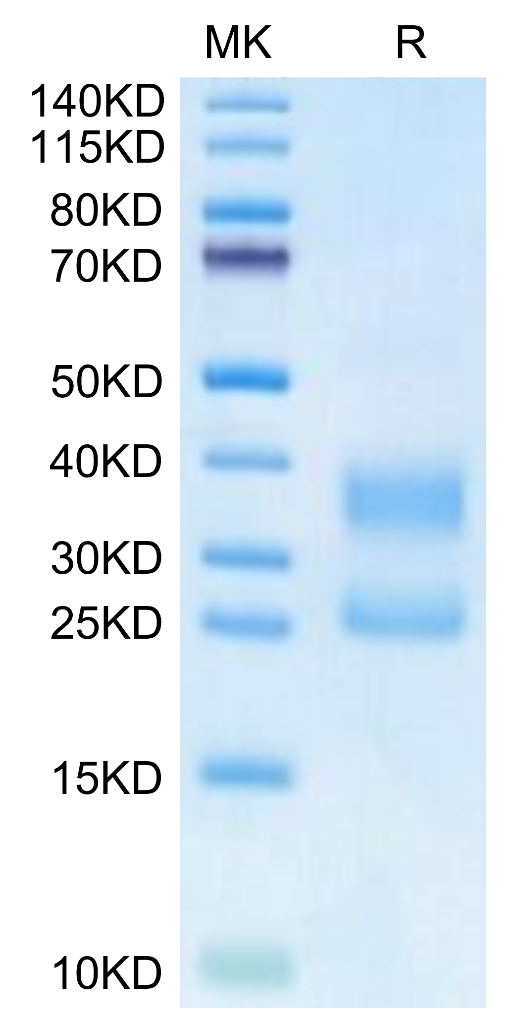 Biotinylated Human CD3E&CD3G on Tris-Bis PAGE under reduced condition. The purity is greater than 95%.