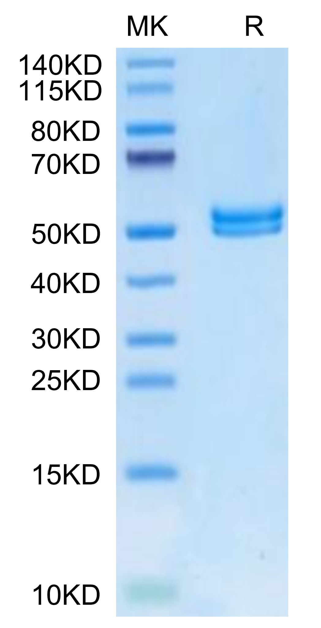 Mouse IL-11R alpha on Tris-Bis PAGE under reduced condition. The purity is greater than 95%.