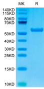 Biotinylated Human HLA-A*02:01&B2M&AFP (FMNKFIYEI) Monomer on Tris-Bis PAGE under reduced condition. The purity is greater than 95%.