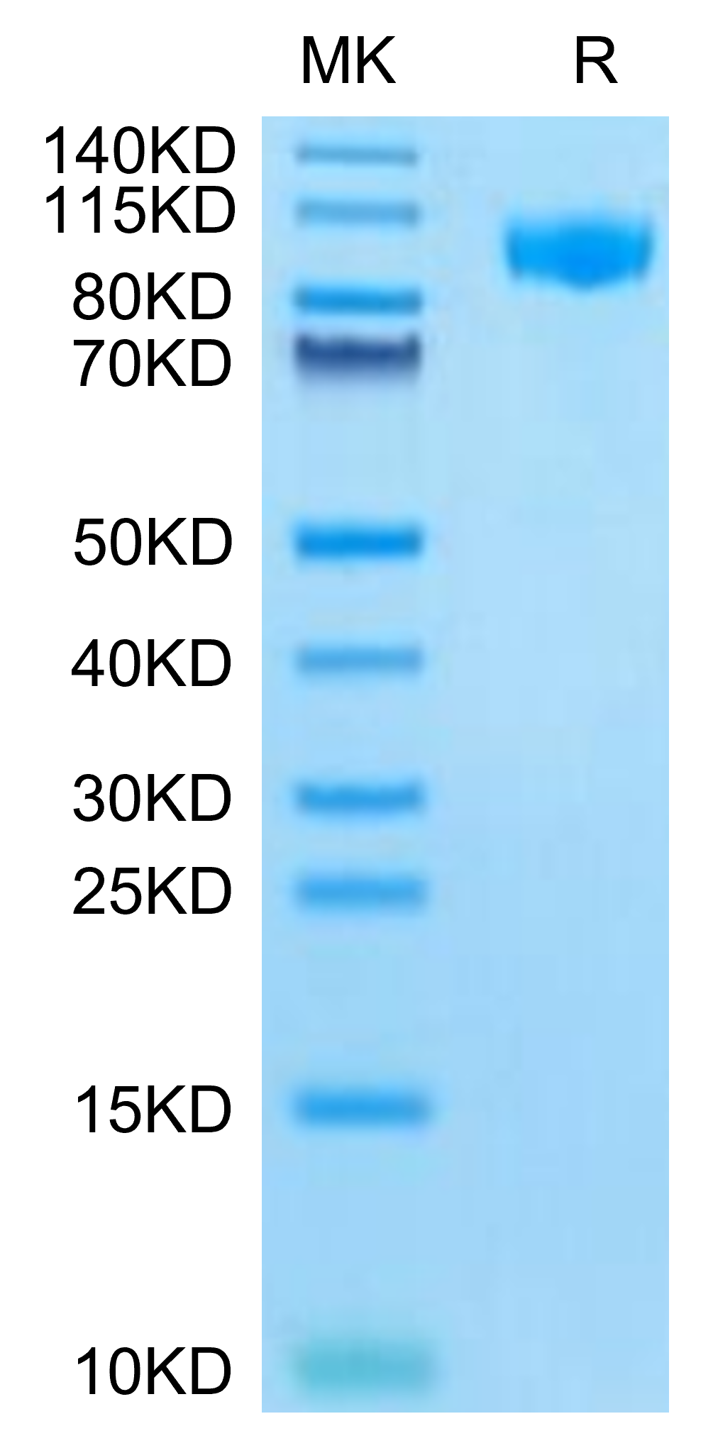 Mouse G-CSF R on Tris-Bis PAGE under reduced condition. The purity is greater than 95%.