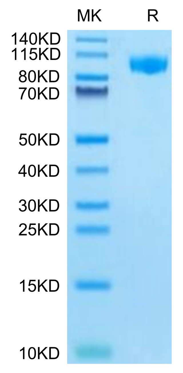 Mouse G-CSF R on Tris-Bis PAGE under reduced condition. The purity is greater than 95%.