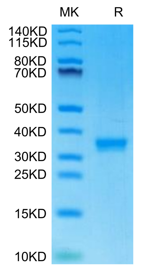 Mouse IgG2C on Tris-Bis PAGE under reduced condition. The purity is greater than 95%.